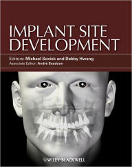 Title: Implant Site Development / Edition 1, Author: Michael Sonick