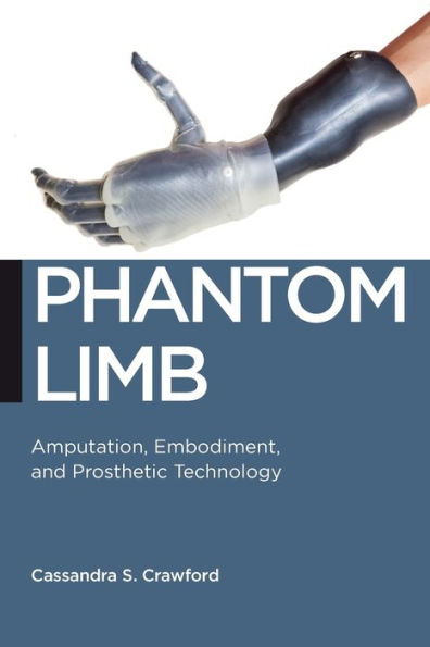 Phantom Limb: Amputation, Embodiment, and Prosthetic Technology