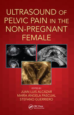 Ultrasound of Pelvic Pain in the Non-Pregnant Patient / Edition 1