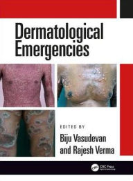 Title: Dermatological Emergencies / Edition 1, Author: Rajesh Verma