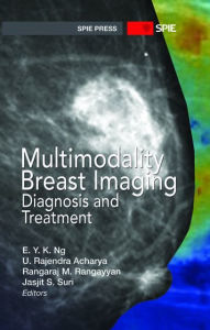 Title: Multimodality Breast Imaging: Diagnosis and Treatment, Author: E. Y. K. Ng