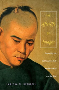 Title: The Afterlife of Images: Translating the Pathological Body between China and the West, Author: Ari Larissa Heinrich