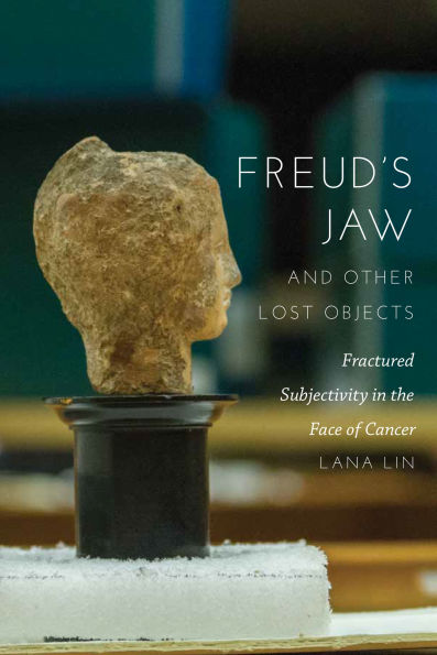 Freud's Jaw and Other Lost Objects: Fractured Subjectivity the Face of Cancer