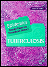 Title: Tuberculosis / Edition 1, Author: Fred Ramen