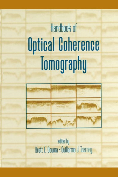 Handbook of Optical Coherence Tomography / Edition 1