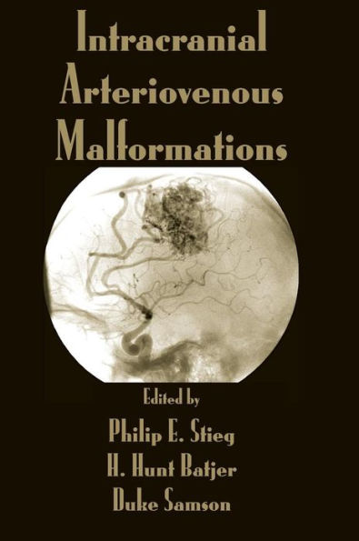 Intracranial Arteriovenous Malformations / Edition 1