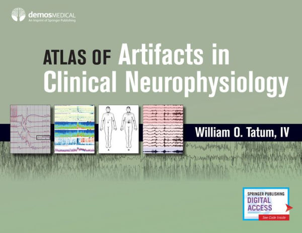 Atlas of Artifacts in Clinical Neurophysiology / Edition 1