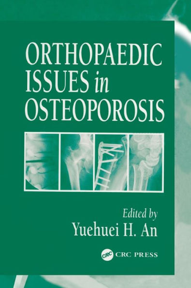 Orthopaedic Issues in Osteoporosis / Edition 1