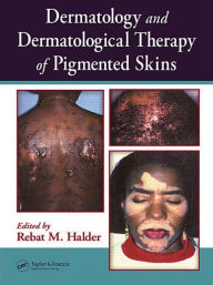 Title: Dermatology and Dermatological Therapy of Pigmented Skins / Edition 1, Author: Rebat Halder