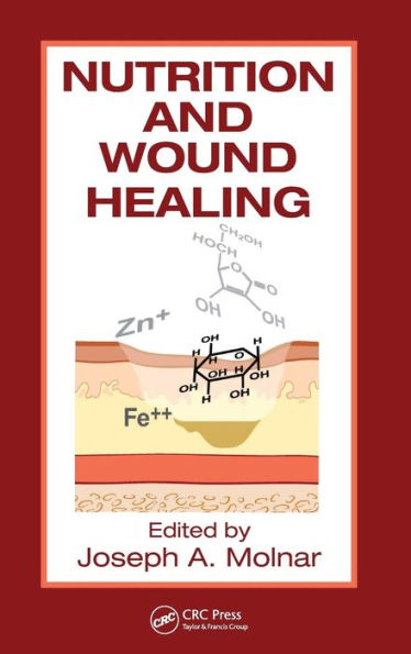 Nutrition and Wound Healing / Edition 1