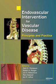 Title: Endovascular Intervention for Vascular Disease: Principles and Practice / Edition 1, Author: Matt M. Thompson