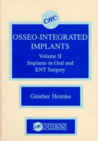 Title: Osseo-Integrated Implants: Implants in Oral and Ent Surgery, Author: Gunther Heimke