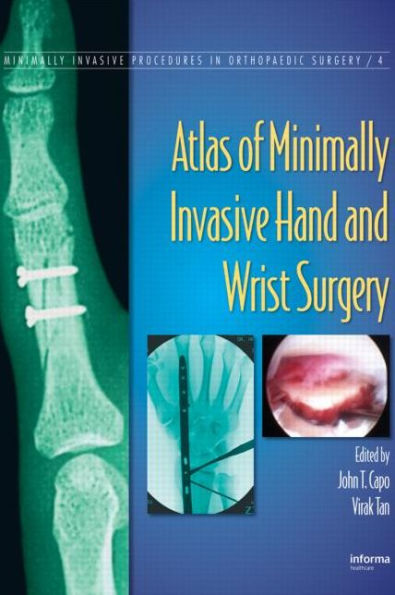 Atlas of Minimally Invasive Hand and Wrist Surgery / Edition 1