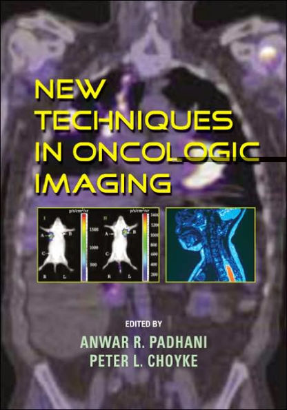 New Techniques in Oncologic Imaging / Edition 1