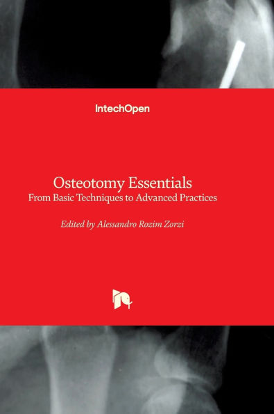 Osteotomy Essentials - From Basic Techniques to Advanced Practices: From Basic Techniques to Advanced Practices