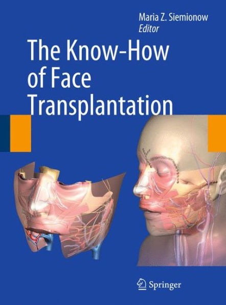 The Know-How of Face Transplantation / Edition 1