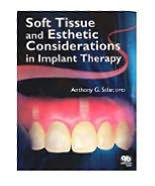 Title: Soft Tissue and Esthetic Considerations in Implant Therapy / Edition 1, Author: Anthony G. Sclar