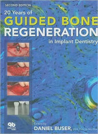 Title: 20 Years of Guided Bone Regeneration in Implant Dentistry / Edition 2, Author: Daniel Buser