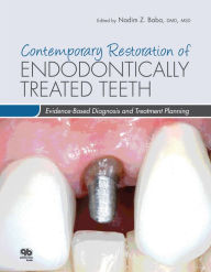 Title: Contemporary Restoration of Endodontically Treated Teeth: Evidence-Based Diagnosis and Treatment Planning, Author: Nadim Z. Baba