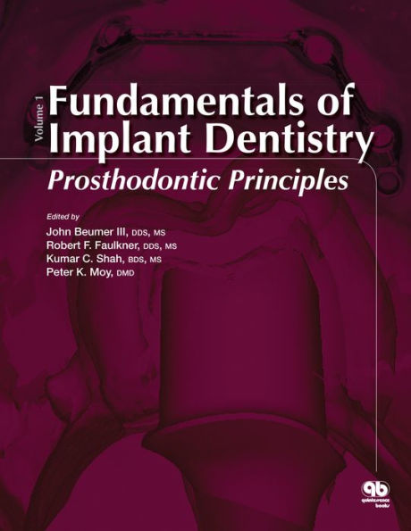 Fundamentals of Implant Dentistry, Volume 1: Prosthodontic Principles