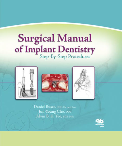 Surgical Manual of Implant Dentistry: Step-by-Step Procedures