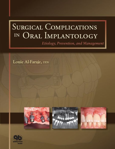 Surgical Complications in Oral Implantology: Etiology, Prevention, and Management