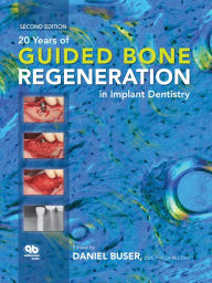 Title: 20 Years of Guided Bone Regeneration in Implant Dentistry: Second Edition, Author: Daniel Buser