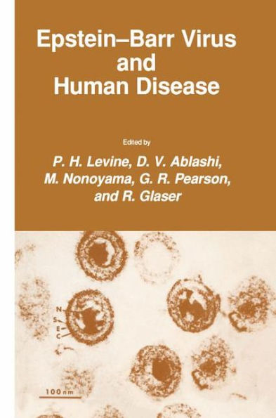 Epstein-Barr Virus and Human Disease / Edition 1