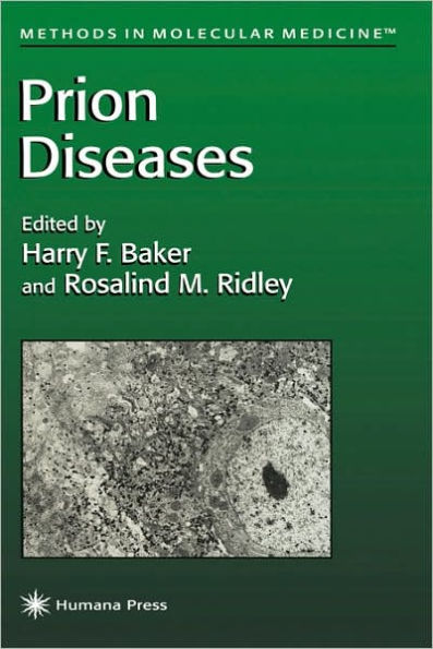 Prion Diseases / Edition 1