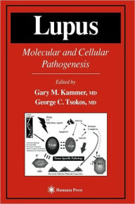 Title: Lupus: Molecular and Cellular Pathogenesis / Edition 1, Author: Gary M. Kammer