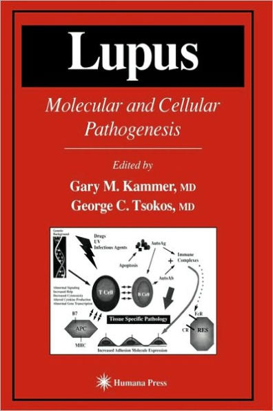 Lupus: Molecular and Cellular Pathogenesis / Edition 1