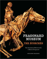 Title: Fragonard Museum: The Ecorches, Author: Christophe Degueurce