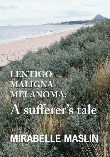 Lentigo Maligna Melanoma: A Sufferer's Tale