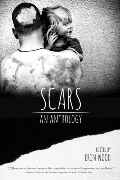 Scars: An Anthology
