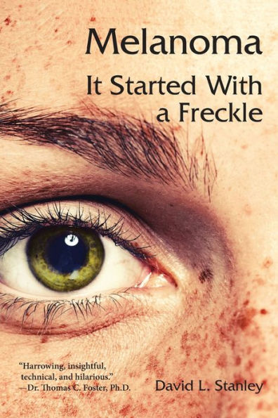 Melanoma: It Started With a Freckle