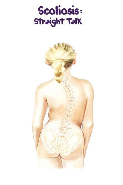 Scoliosis: Straight Talk