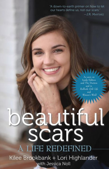 Beautiful Scars: A Life Redefined