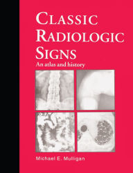 Title: Classic Radiologic Signs: An Atlas and History, Author: M.E. Mulligan
