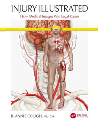 Title: Injury Illustrated: How Medical Images Win Legal Cases, Author: R. Annie Gough