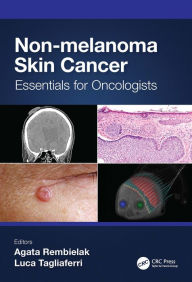 Title: Non-melanoma Skin Cancer: Essentials for Oncologists, Author: Agata Rembielak