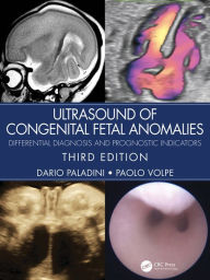 Title: Ultrasound of Congenital Fetal Anomalies: Differential Diagnosis and Prognostic Indicators, Author: Dario Paladini