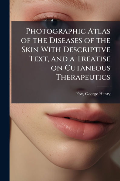 Photographic Atlas of the Diseases Skin With Descriptive Text, and a Treatise on Cutaneous Therapeutics
