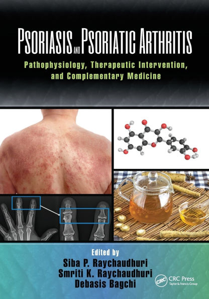 Psoriasis and Psoriatic Arthritis: Pathophysiology, Therapeutic Intervention, and Complementary Medicine