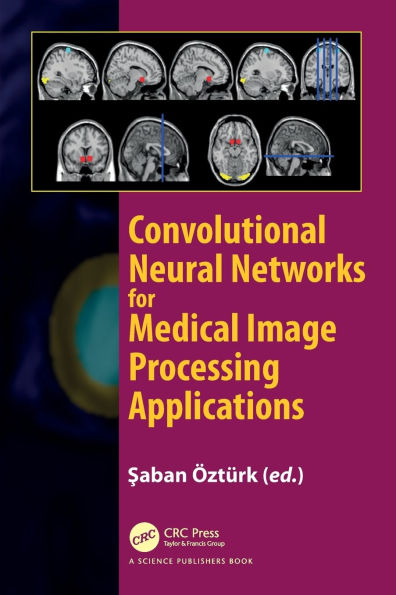 Convolutional Neural Networks for Medical Image Processing Applications