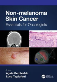 Title: Non-melanoma Skin Cancer: Essentials for Oncologists, Author: Agata Rembielak