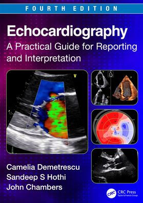 Echocardiography: A Practical Guide for Reporting and Interpretation