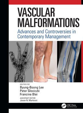 Vascular Malformations: Advances and Controversies in Contemporary Management