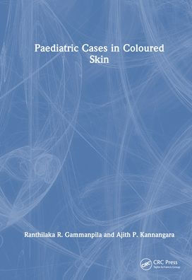 Paediatric Cases Coloured Skin