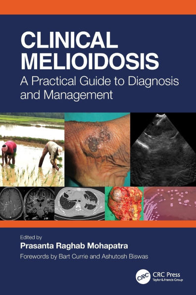 Clinical Melioidosis: A Practical Guide to Diagnosis and Management