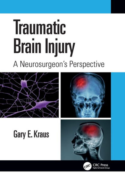 Traumatic Brain Injury: A Neurosurgeon's Perspective